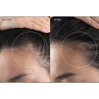 FAQ™ 301 LED Hair Strengthening Scalp Massager