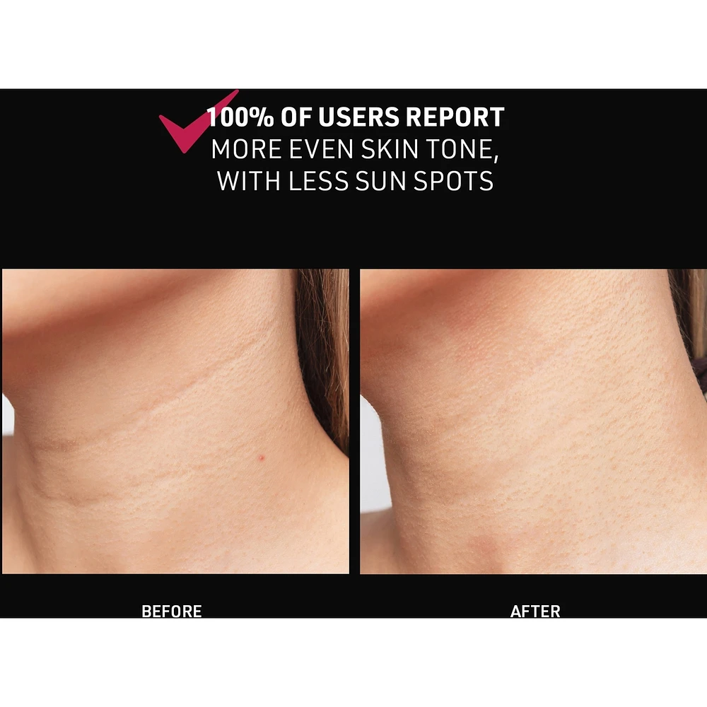 FAQ™ 211 Silicone LED + Near-Infrared Neck & Décolleté Mask