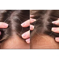 FAQ™ Scalp Recovery & Thick Hair Probiotic Serum