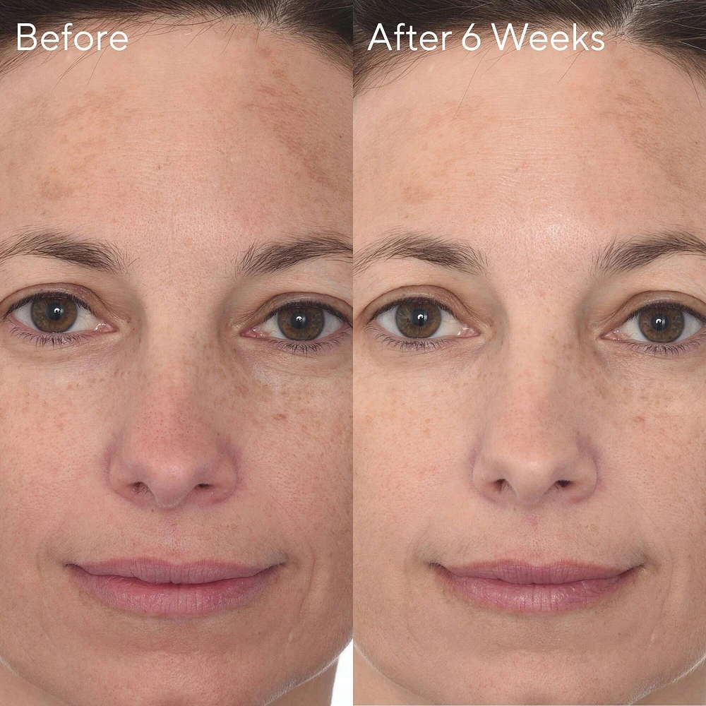 Rapid Dark Spot Correcting Serum