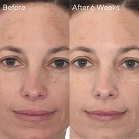 Rapid Dark Spot Correcting Serum
