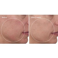 Cellular Hydration Barrier Repair Cream