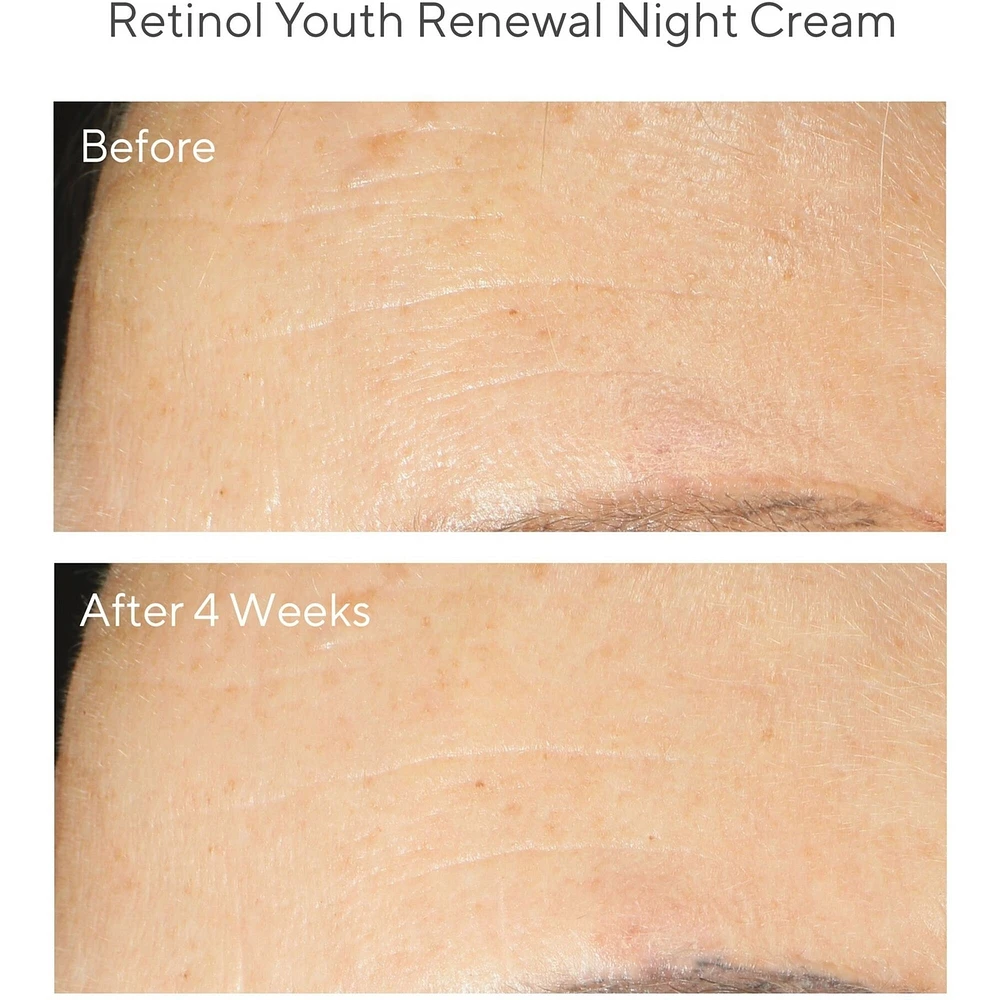 Retinol Youth Renewal Night Cream