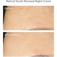 Retinol Youth Renewal Night Cream