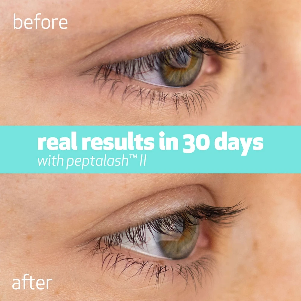 peptalash™ II - eyelash enhancing serum