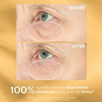 Hyperlift Eye™ Instant Eye Fix Treatment