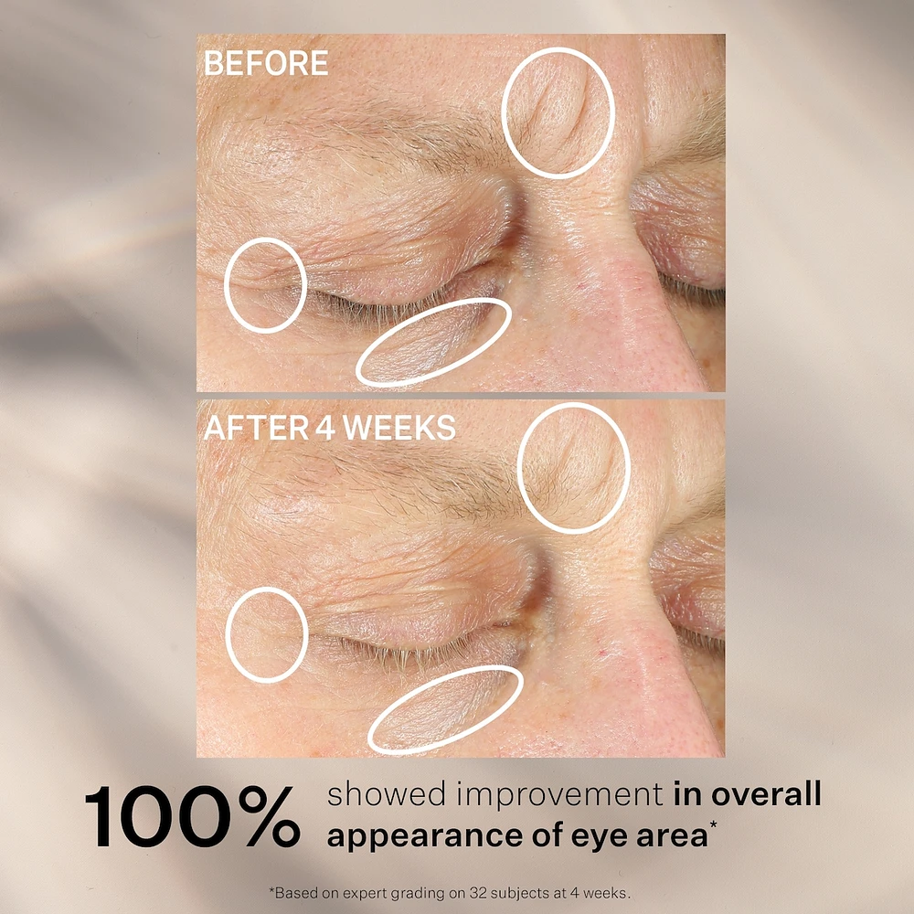 Soin Concentre Intense Pour Les Yeux Anti-rides Plus