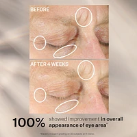 Soin Concentre Intense Pour Les Yeux Anti-rides Plus