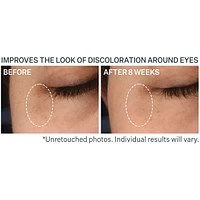 Super-C Dark Circle Brightening Eye Serum