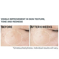 Super-C SPF 30 Vitamin C Moisturizer 50mL