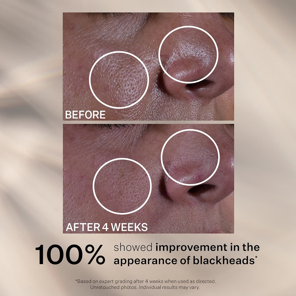 Multi-Action Super Shrink SÉRUM MINIMISEUR DE PORES