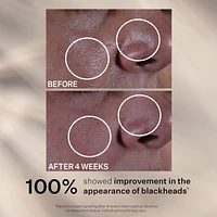 Multi-Action Super Shrink SÉRUM MINIMISEUR DE PORES