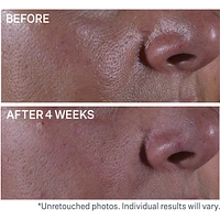 Multi-Action Super Shrink Pore Minimizing Serum