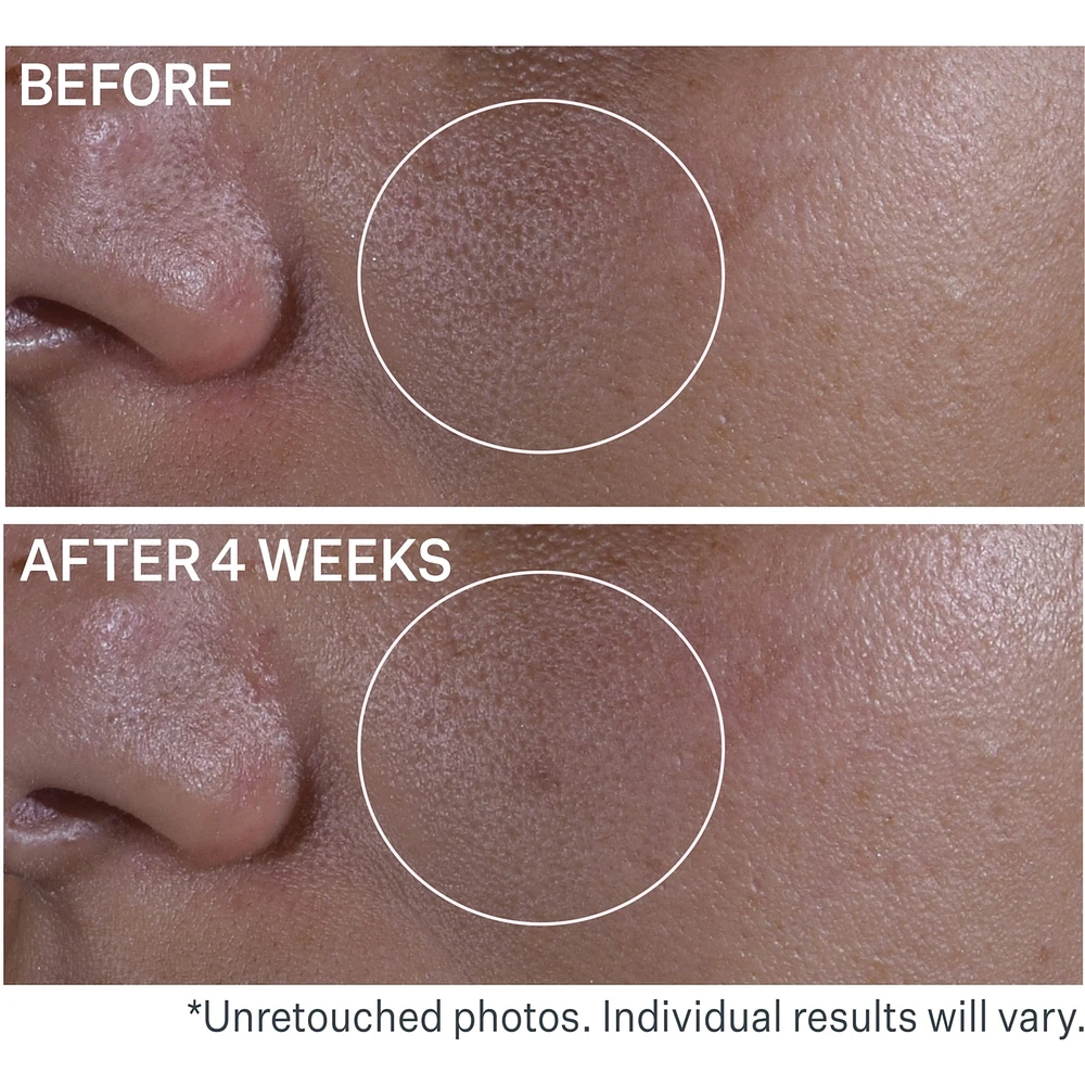 Multi-Action Super Shrink Pore Minimizing Serum