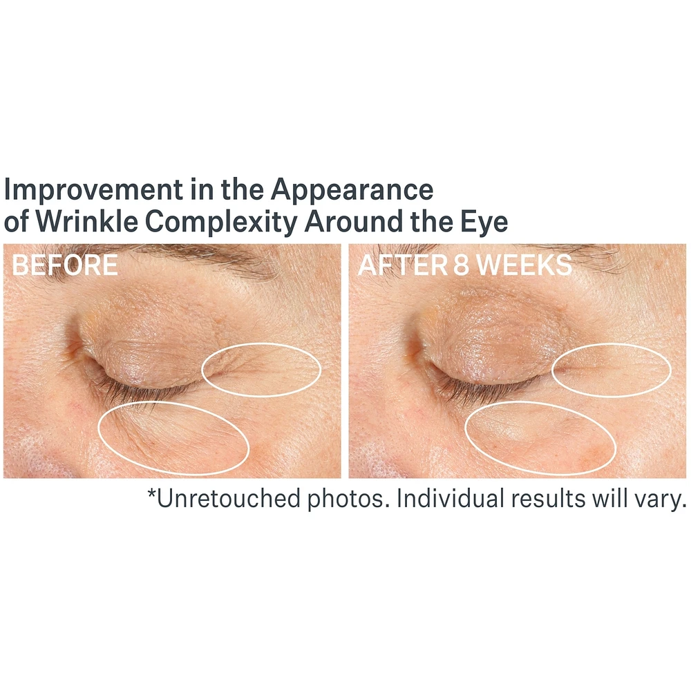 Advanced Retinol Multi-Correct Eye Cream