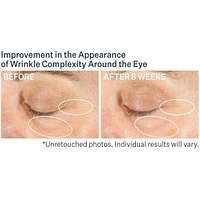 Advanced Retinol Multi-Correct Eye Cream