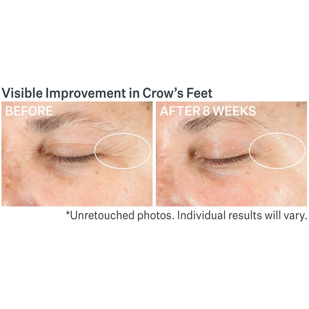 Advanced Retinol Multi-Correct Eye Cream