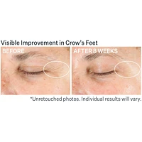 Advanced Retinol Multi-Correct Eye Cream