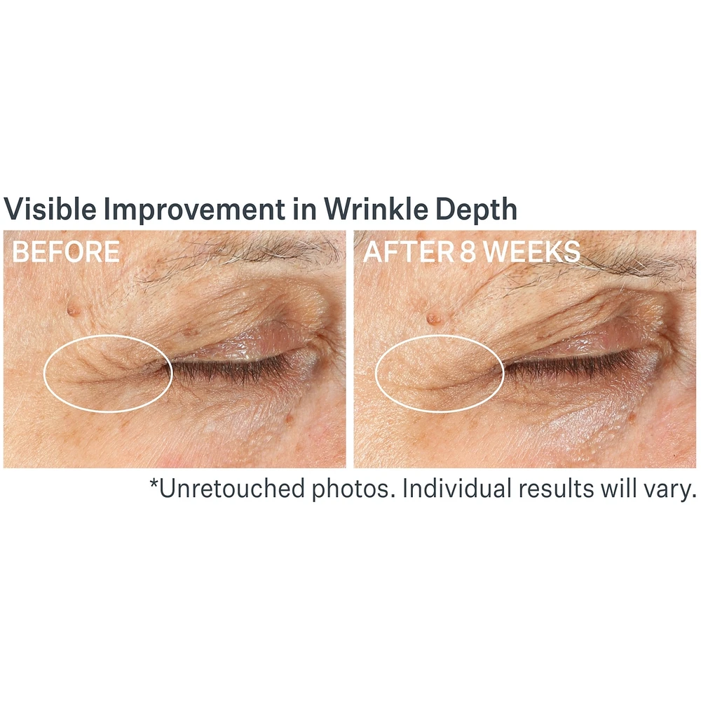 Advanced Retinol Multi-Correct Eye Cream
