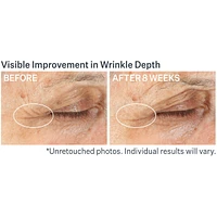 Advanced Retinol Multi-Correct Eye Cream