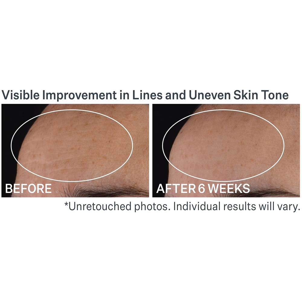 Advanced Retinol Nightly Multi-Correct Serum
