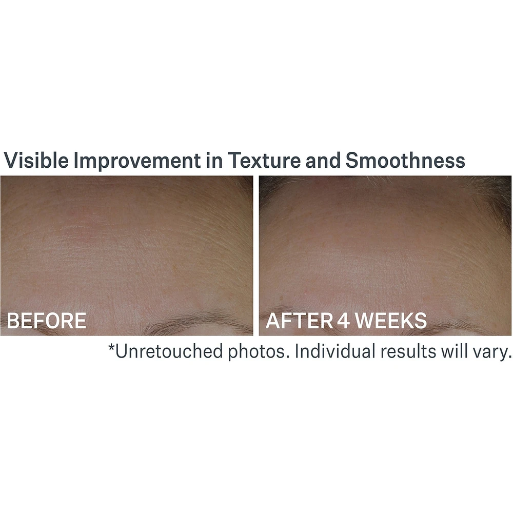 Anti-Wrinkle Peptide Plump™ Line Filling Bounce Serum