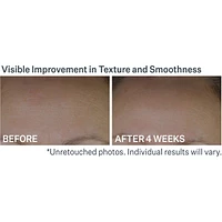 Anti-Wrinkle Peptide Plump™ Line Filling Bounce Serum