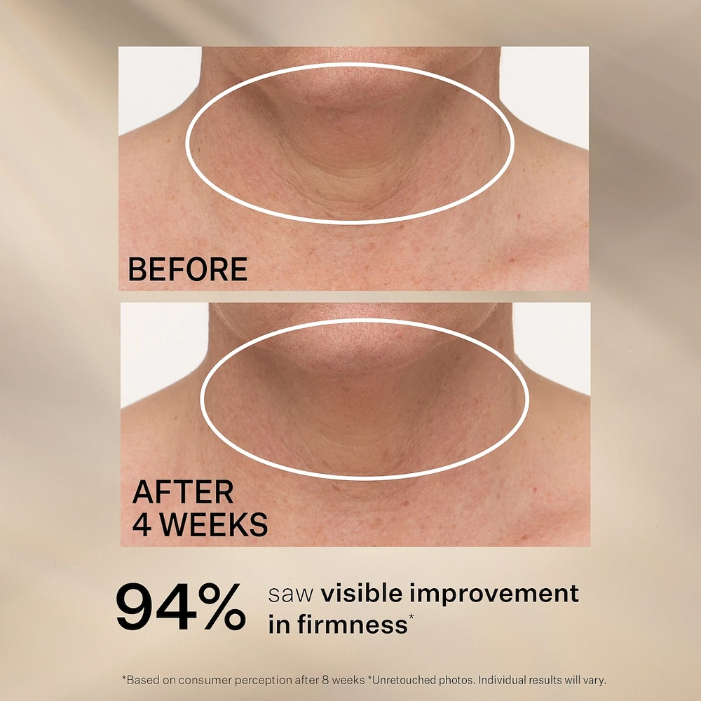 Effet Liftant Optimal Crème Pour Le Cou En Format Bonus