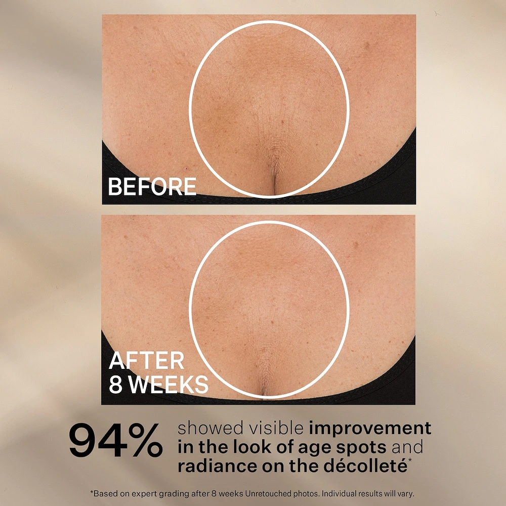Effet Liftant Optimal Crème Pour Le Cou En Format Bonus