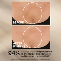 Effet Liftant Optimal Crème Pour Le Cou En Format Bonus