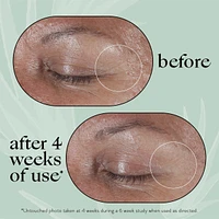 Calm and Renew Eye Balm