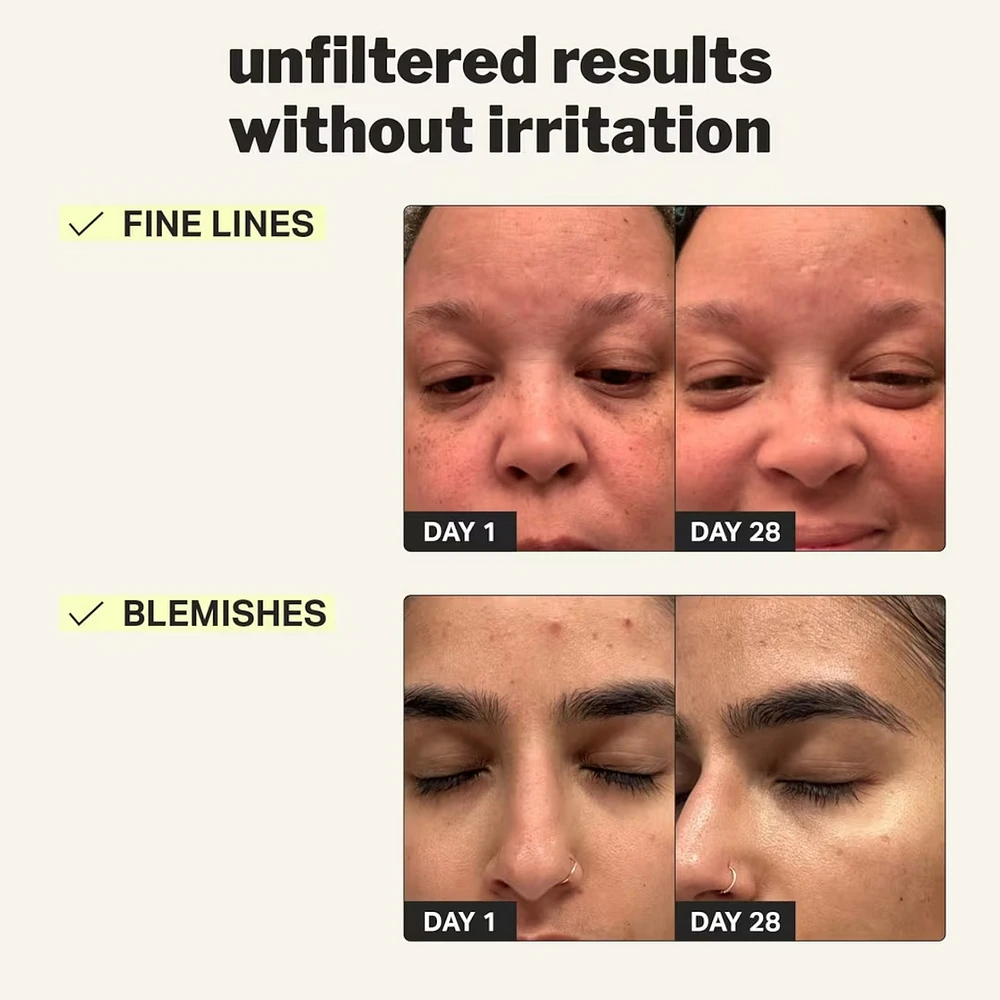 beginner retinol gel