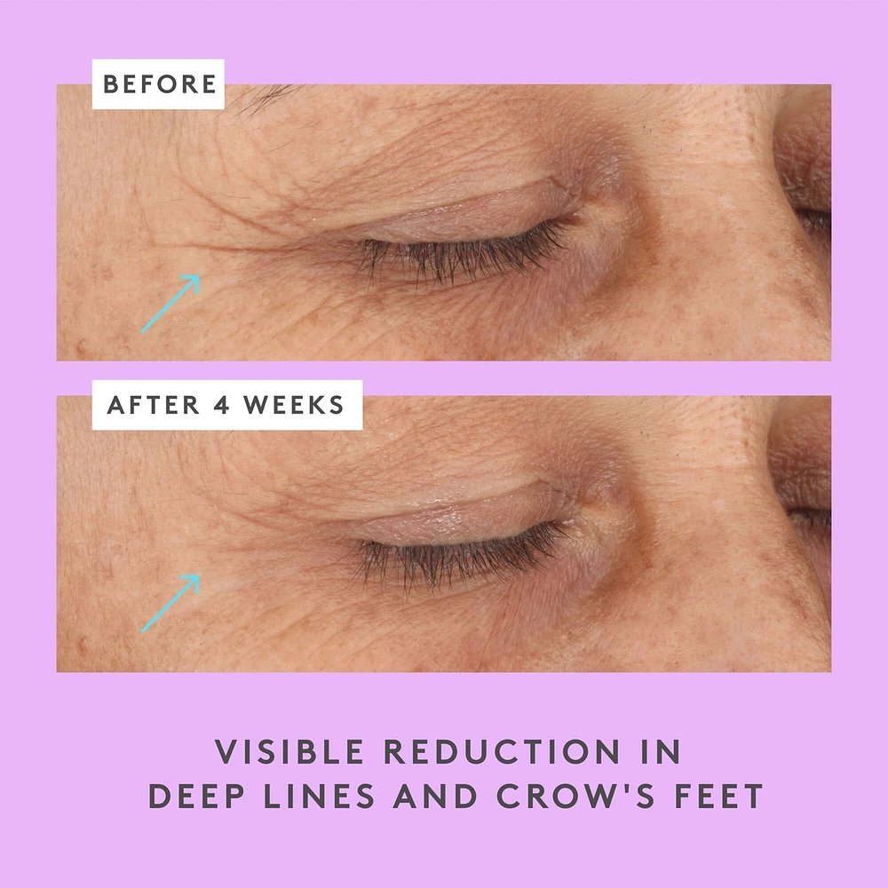 Ceramighty™ AF Eye Balm