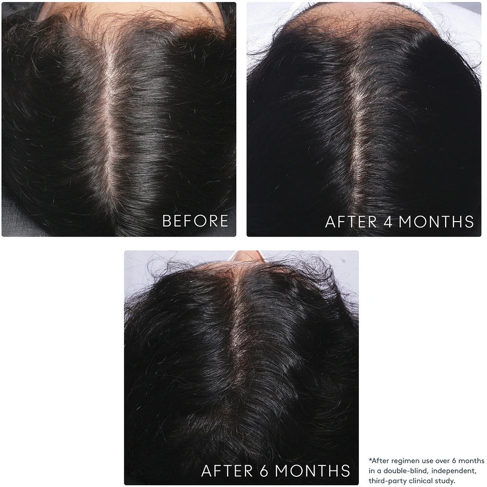 Flourish® Shampoo for Thinning hair