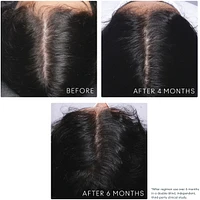 Flourish® Shampoo for Thinning hair