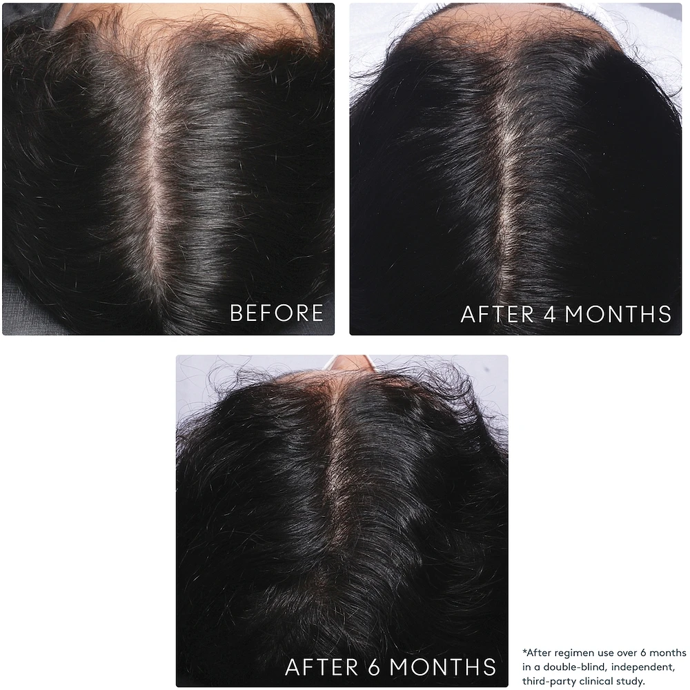 Flourish® Conditioner for Thinning hair
