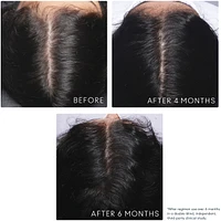 Flourish® Conditioner for Thinning hair
