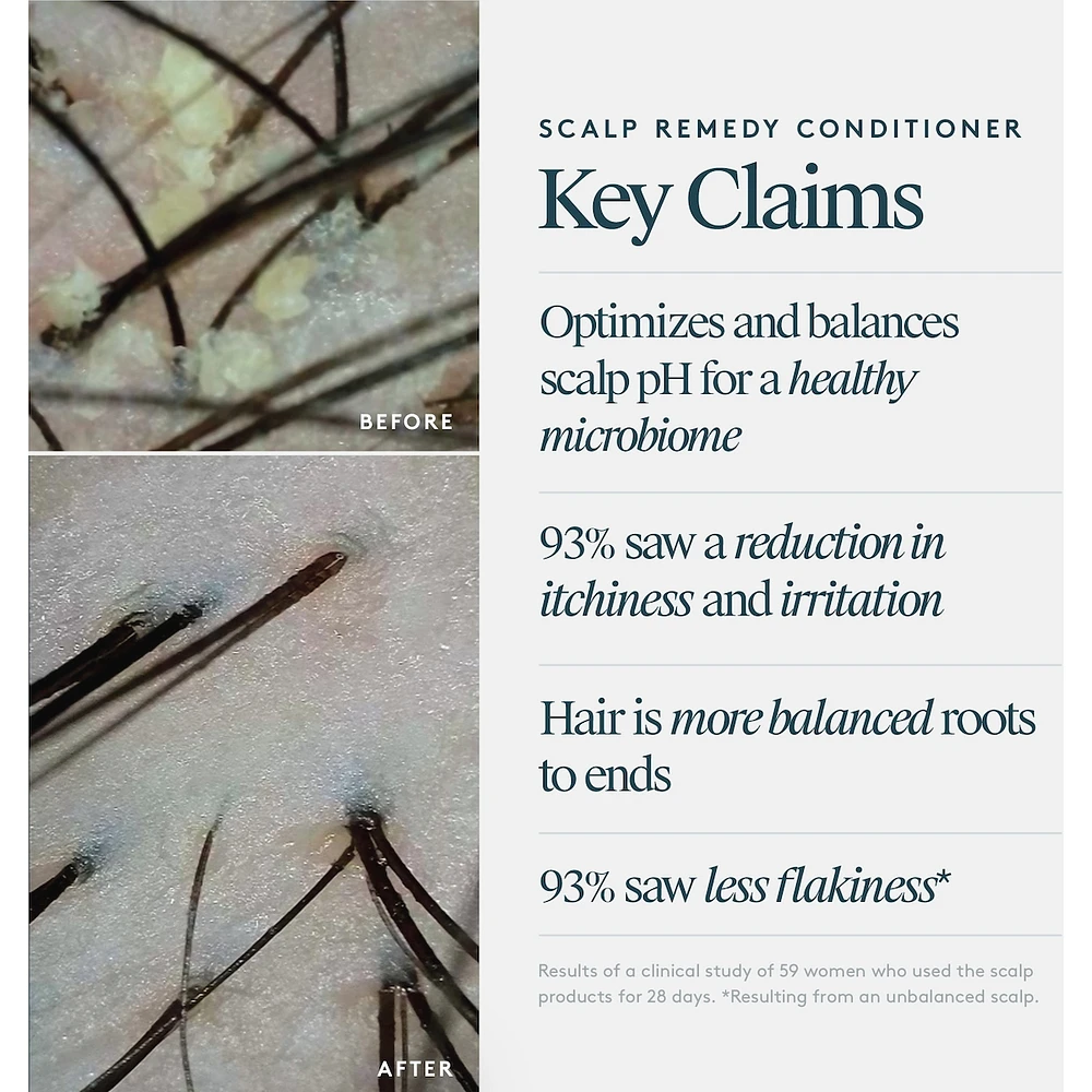 Scalp Remedy Conditioner