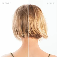 Scalp Remedy Shampoo