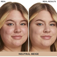 Bye Redness™ Correcting Cream & Foundation