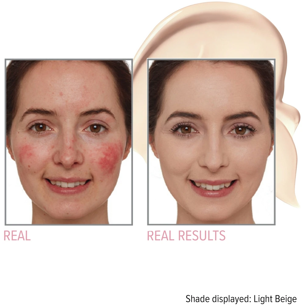 Bye Redness™ Correcting Cream & Foundation