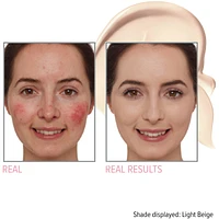 Bye Redness™ Correcting Cream & Foundation