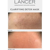 Clarifying Detox Mask with Green Tea