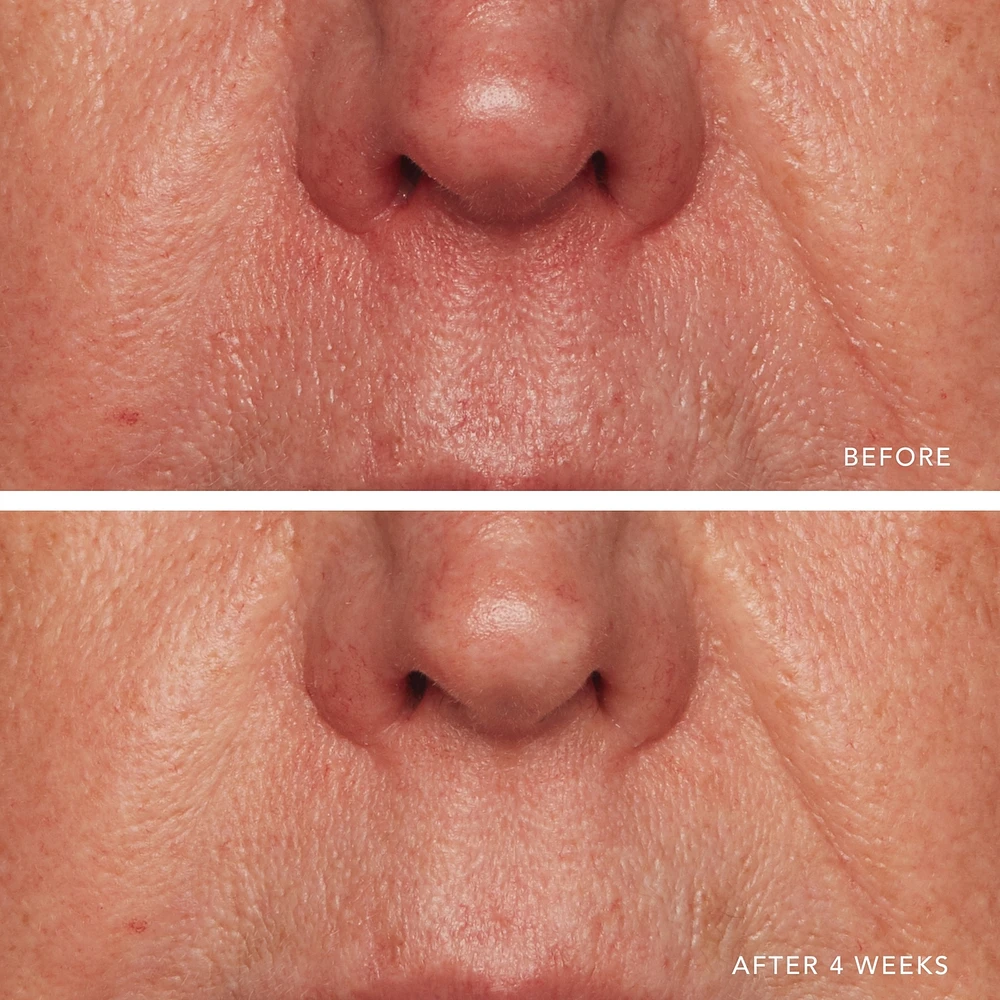 Redness Relief Intense with Manuka Honey