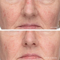 Ultra Hydrating Serum with Hyaluronic Complex-7