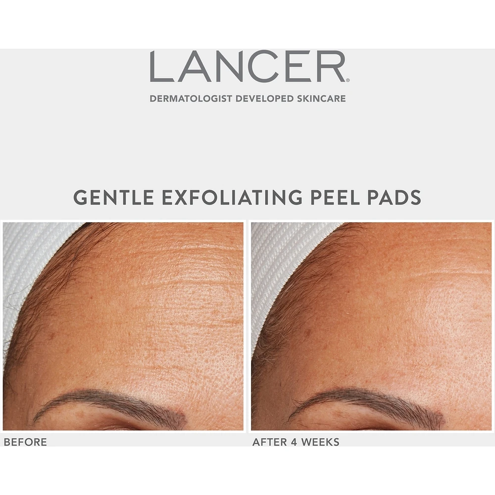Gentle Exfoliating Peel Pads with 7% Lactic Acid + Bakuchiol