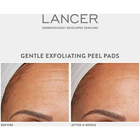 Gentle Exfoliating Peel Pads with 7% Lactic Acid + Bakuchiol
