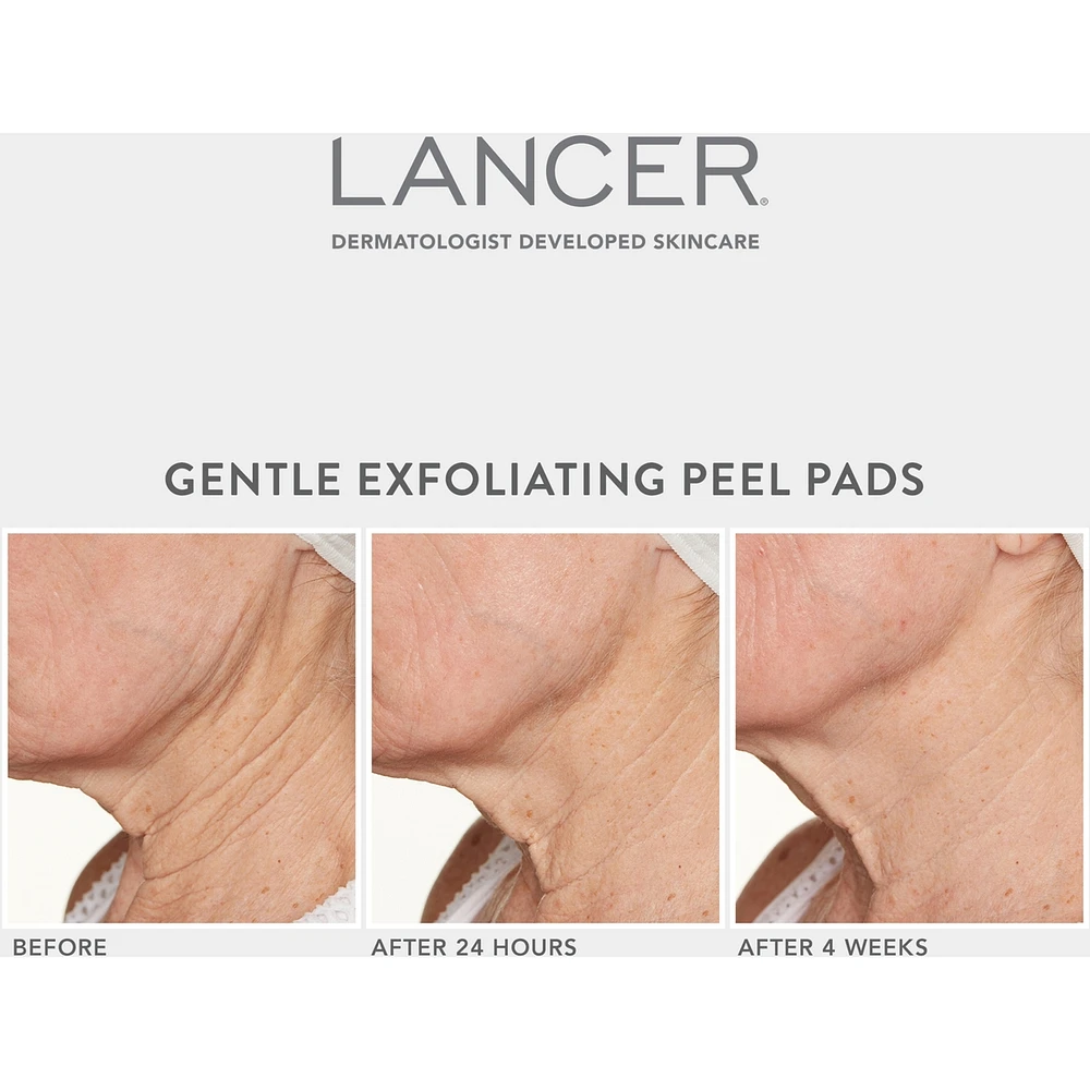 Gentle Exfoliating Peel Pads with 7% Lactic Acid + Bakuchiol