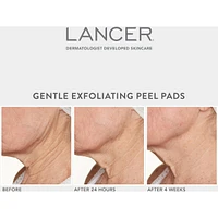 Gentle Exfoliating Peel Pads with 7% Lactic Acid + Bakuchiol