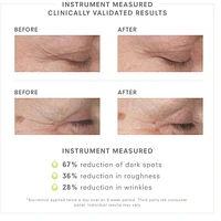 Stem Cellular Anti-Wrinkle retinol Overnight Serum